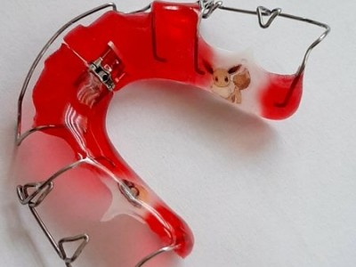 Nakładka na zęby w kolorze czerwonym